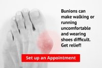 Are Bunions Affecting Your Everyday Life?